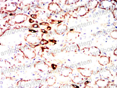 Валидация AntibodySystem RHD71003