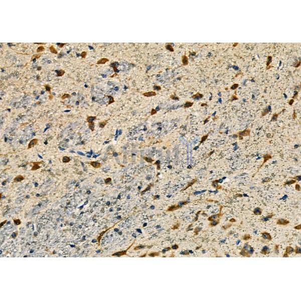 Валидация Affinity DF3261 - 14114