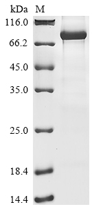 SDS-PAGE