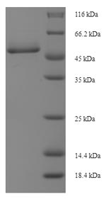 SDS-PAGE