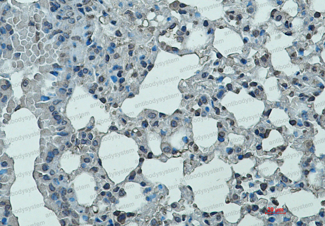 Валидация AntibodySystem RMD41001