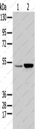 Вестерн-блоттинг, EGR2, клетки HEPG2 и 231