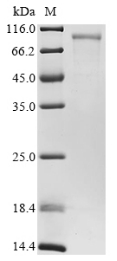 SDS-PAGE