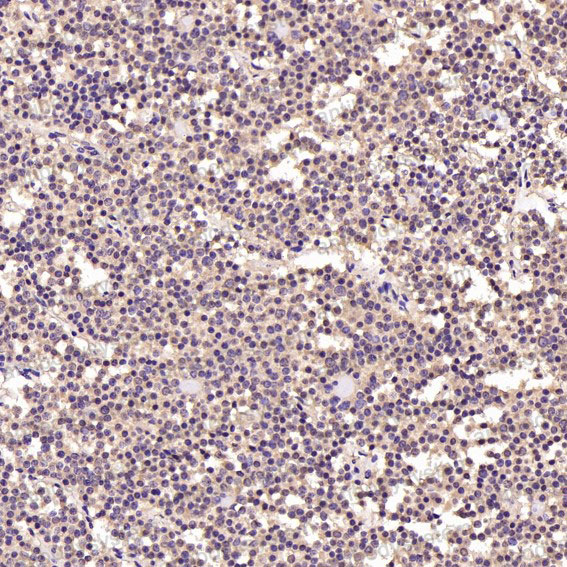 Валидация AntibodySystem RHD96504 (1876)