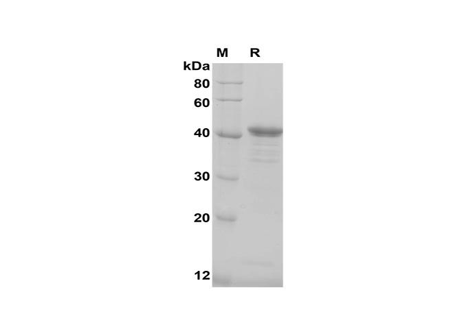 PDEH101150, электрофорез в ПААГ с ДСН