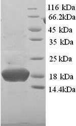SDS-PAGE