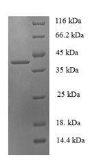 SDS-PAGE