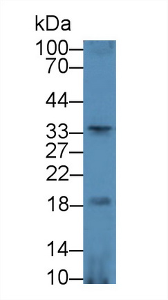12953
