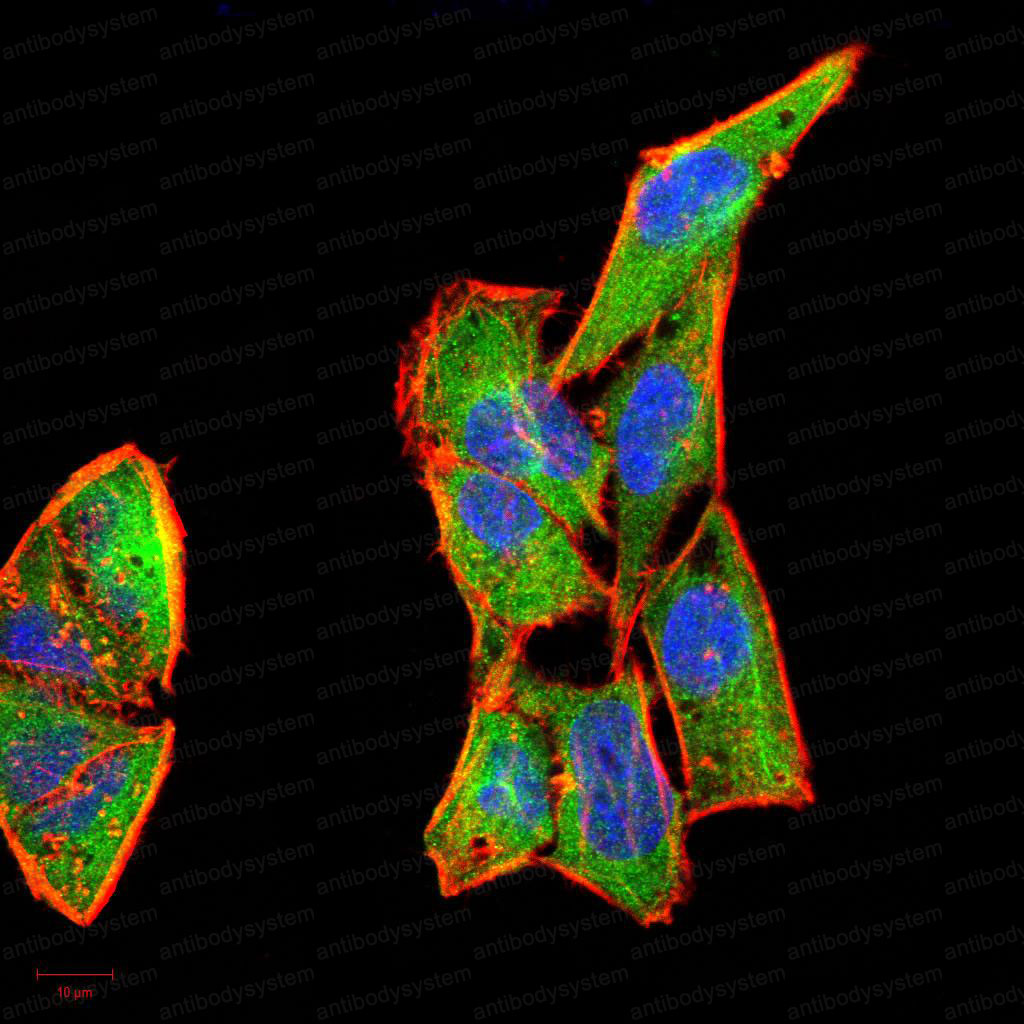 Валидация IF - AntibodySystem RHC44302