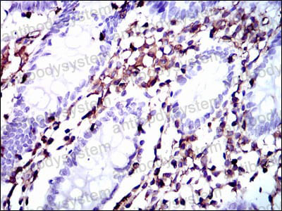 Валидация AntibodySystem RHD69504