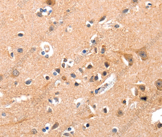 Иммуногистохимия, YWHAG, ткань мозга человека