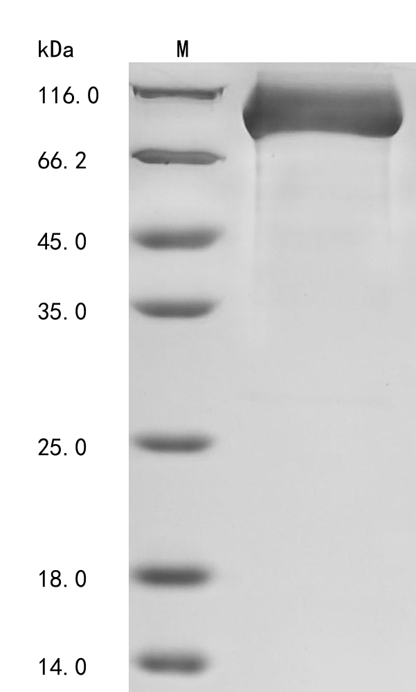SDS-PAGE