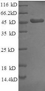 SDS-PAGE