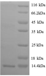 SDS-PAGE