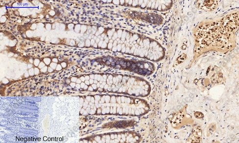 Иммуногистохимия, Phospho-PI 3 kinase p85 alpha /gamma (Tyr467/199), ткань толстой кишки человека