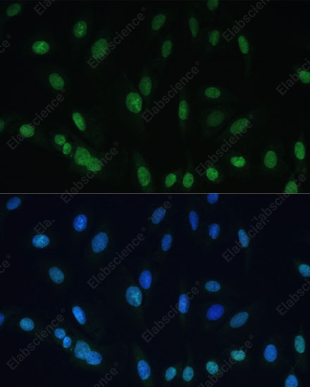 Иммунофлуоресценция, Histone H2AX, клетки U-2 OS