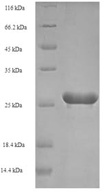SDS-PAGE