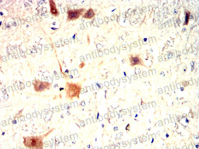 Валидация AntibodySystem RHD06804 (1307)