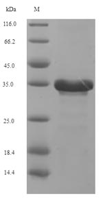 SDS-PAGE