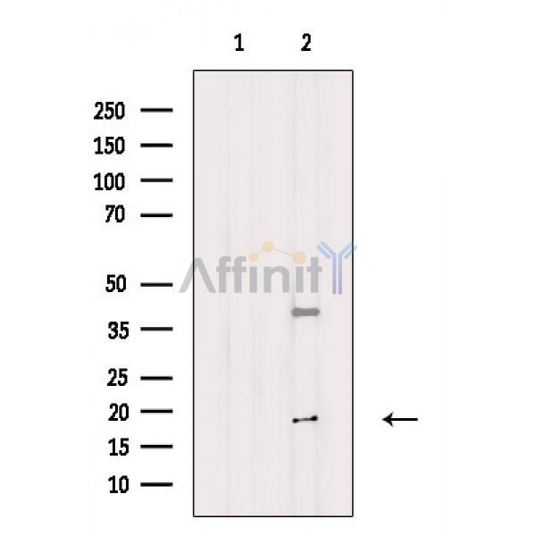 Валидация Affinity DF8766 - 20795