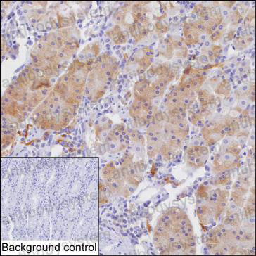 Валидация AntibodySystem RHJ09501