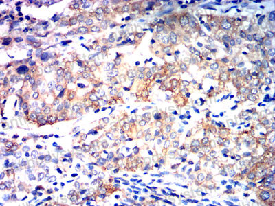 Валидация AntibodySystem RHK13701