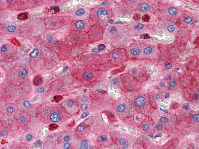 Валидация AntibodySystem RHB56401