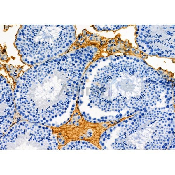 Валидация Affinity DF6874 - 18461