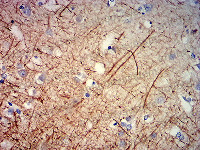 Валидация AntibodySystem RHC91703 (1179)