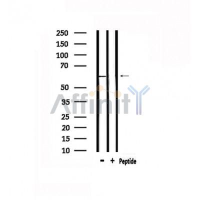 Валидация Affinity DF4887 - 16679