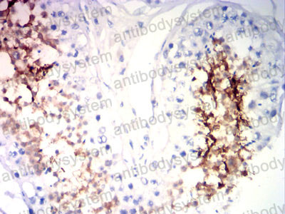 Валидация AntibodySystem RHH11501 (3179)