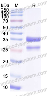 YHG09401, SDS-PAGE