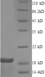 SDS-PAGE