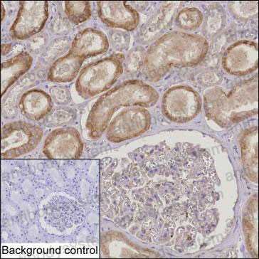 Валидация AntibodySystem RHP02701