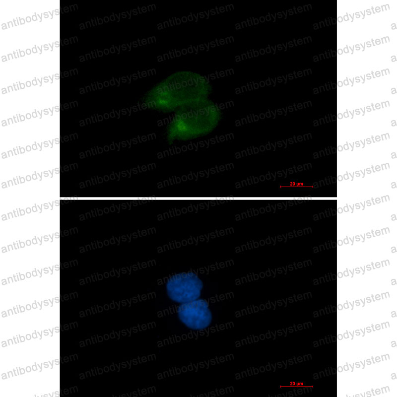Валидация IF - AntibodySystem RHB50601