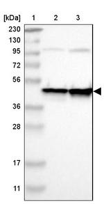 Валидация AssayVector ARM2118(3389)
