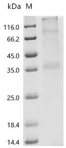 SDS-PAGE