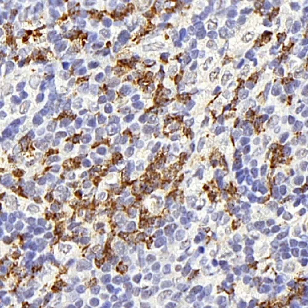 Иммуногистохимия, CD177, ткань тимуса крысы