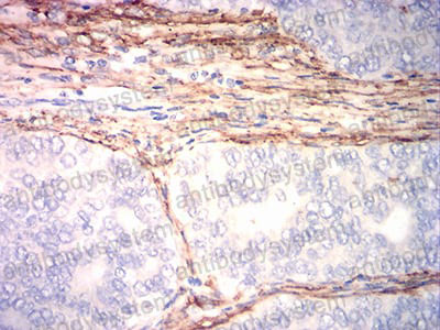 Валидация AntibodySystem RHF52705