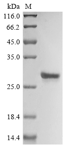 SDS-PAGE