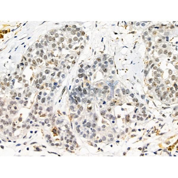 Валидация Affinity DF13671 - 9248