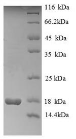 SDS-PAGE