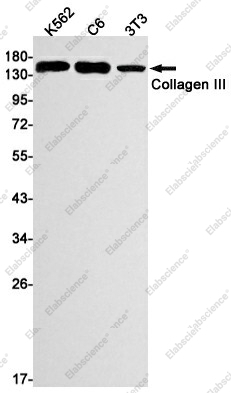 Вестерн-блоттинг, Collagen III, клетки K562, C6, 3T3