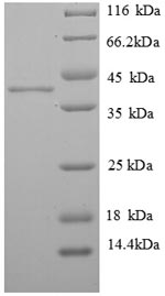 SDS-PAGE