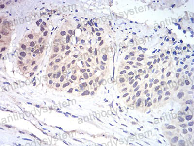 Валидация AntibodySystem RHD97505