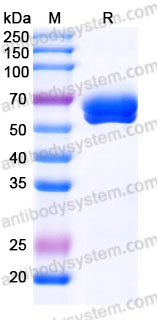 AHJ28402, SDS-PAGE