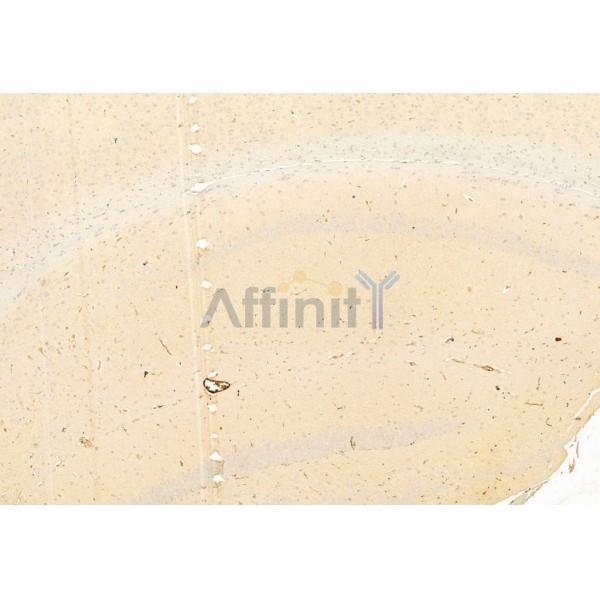 Валидация Affinity AF6009 - 3196