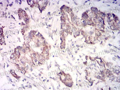 Валидация AntibodySystem RHF80803