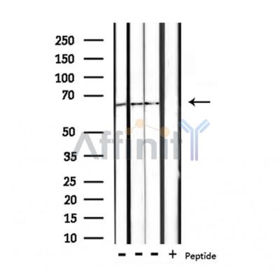 Валидация Affinity DF8525 - 20399