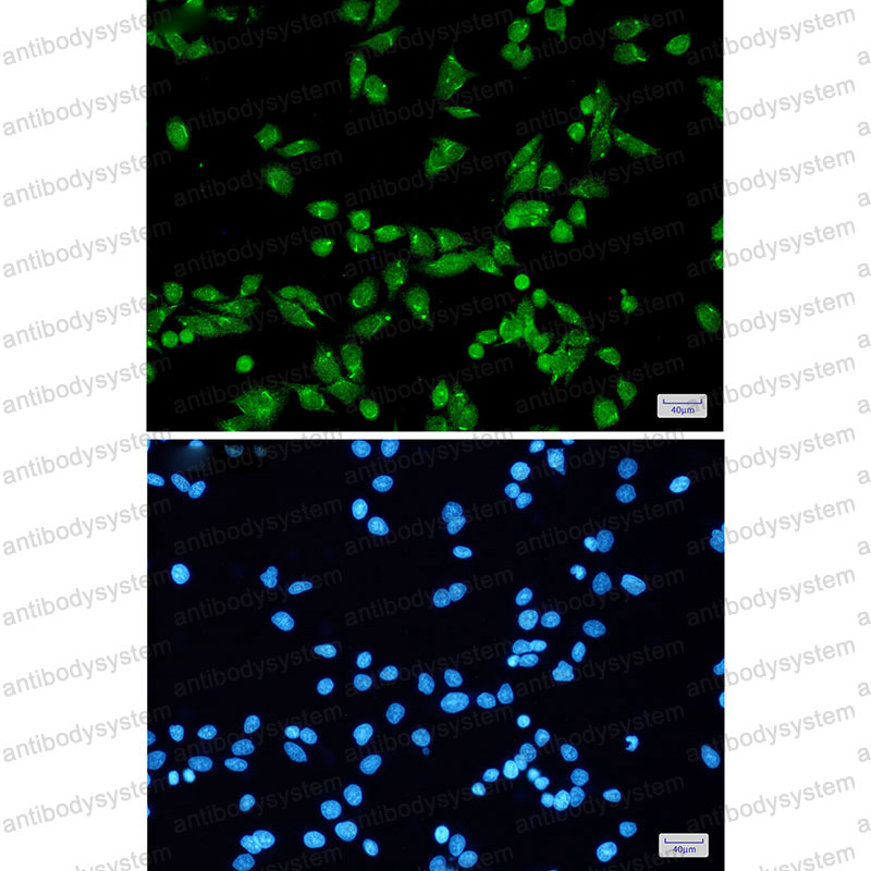 Валидация IF - AntibodySystem RHN64701